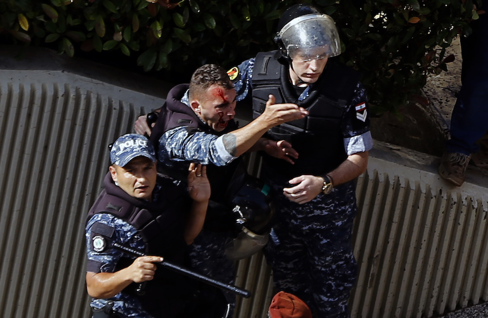An injured police officer shouts during a protest in Beirut, Lebanon, Monday. (AP)