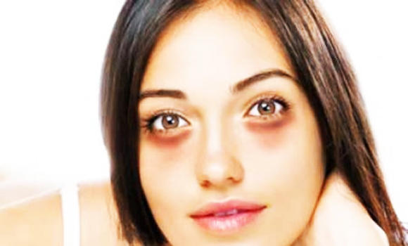 Wave goodbye to your under eye circles | Arab News