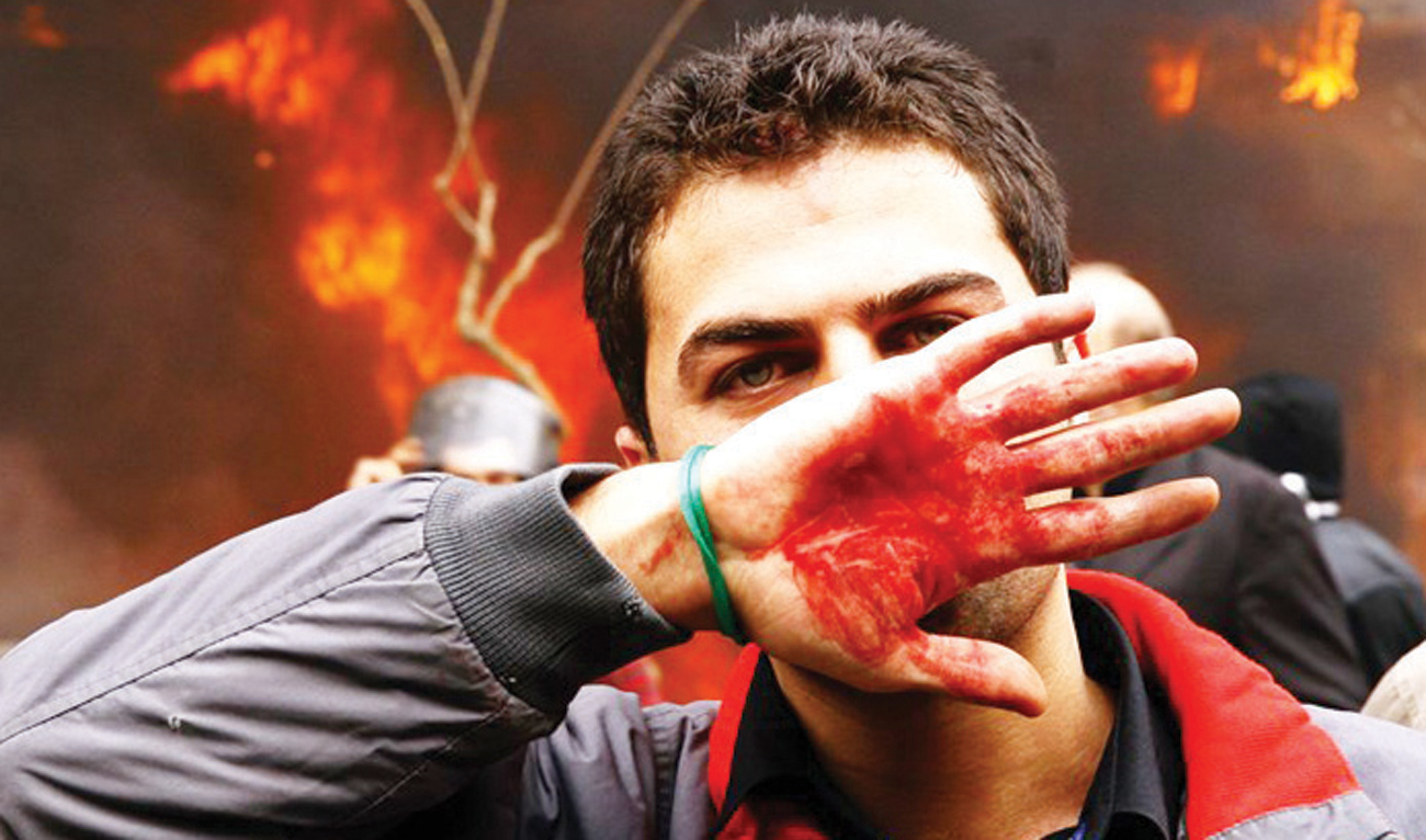 An Iranian covers his face with his bloodied hand during clashes with security forces in Tehran. Protests broke out in Iran against increase in fuel prices. (File/AFP)