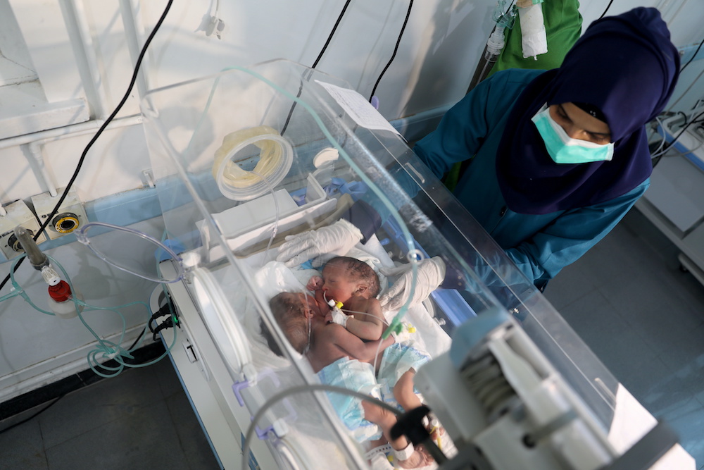 A nurse attends to newly born conjoined twins in an incubator at the child intensive care unit of Al-Sabeen hospital in Sanaa, Yemen Dec. 18, 2020. (Reuters)