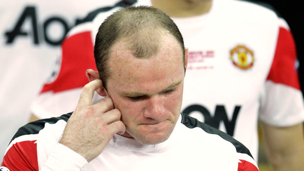 The bald truth: Rooney goes for hair transplant | Arab News