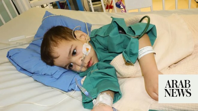 جراح أطفال سعودي يصدر تحديثًا إيجابيًا بشأن التوأم السيامي السوري