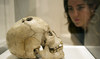 A woman looks at a bronze age skull from Jericho, dated to between 2200 and 2000 BCE, showing the ancient surgical procedure of trephination. (AFP)