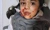 Bloodied and terrified Iraqi schoolchildren embody the human cost of Iranian aggression