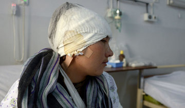 Afghan woman mutilated by husband seeks treatment abroad