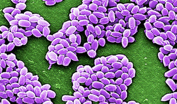 US Army mistakenly shipped live anthrax samples