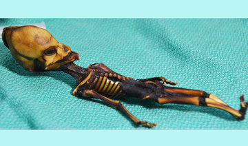 Tiny Atacama skeleton was girl with bone disease: study