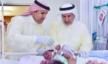 Conjoined twins to be separated on Sunday in Riyadh