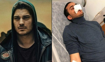 Egyptian stunt double of Turkish actor hospitalized after hate attack in Istanbul 