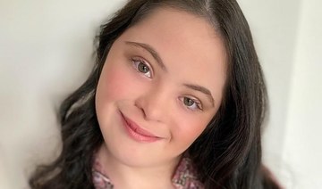 Gucci Beauty’s newest face is a teen with Down syndrome
