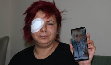 Woman close to being blind after botched Turkey treatment