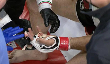 MMA fighter has finger severed in match; doctors reattach it