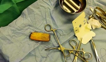 Doctors in Egypt extract mobile phone from patient’s stomach 