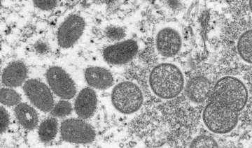 UAE announces five new cases of monkeypox
