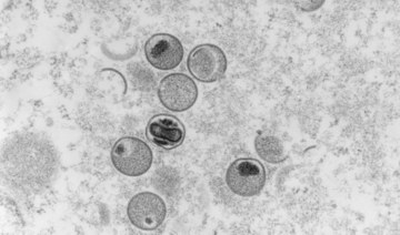 UAE announces 3 new monkeypox cases