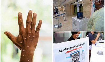 Should Saudi Arabia be worried about monkeypox?