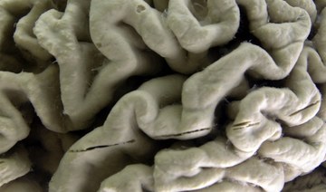 US approves new drug to treat Alzheimer’s