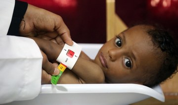 540,000 children in Yemen ‘starving’: UNICEF