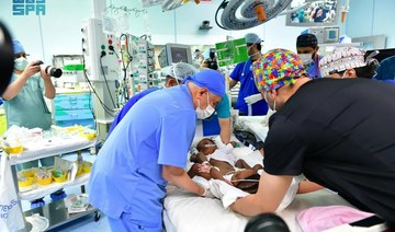 Saudi surgeons successfully complete complex 16-hour operation separating Nigerian conjoined twins