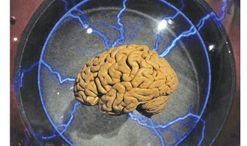 Coming soon: A brain implant to restore memory