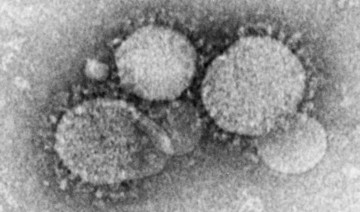 5 new coronavirus cases found in eastern region