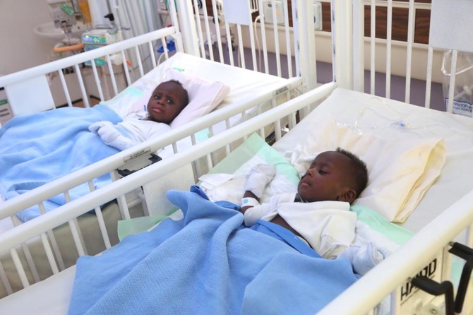 Separated Sudanese conjoined twins moved to pediatric ward
