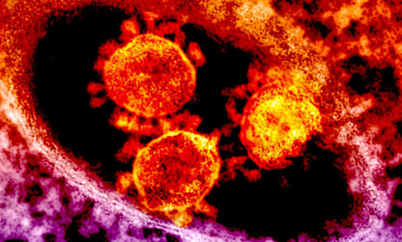 Man from Riyadh dies of MERS; 3 new cases