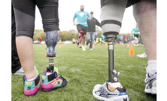 World’s first ‘feeling’ leg prosthesis offers amputees new hope