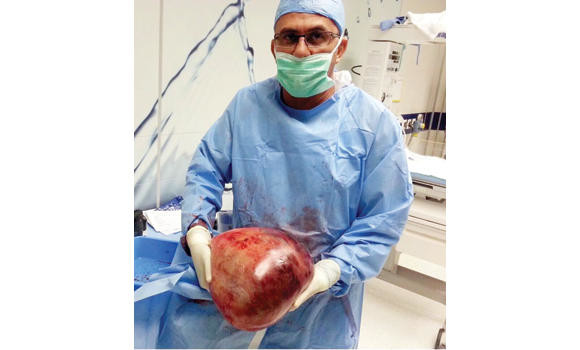 18kg cyst removed from 17-year-old girl