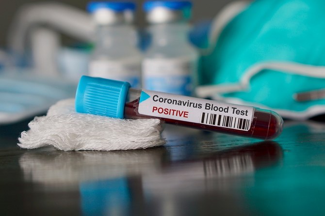 UAE confirms 2 new coronavirus cases | Arab News