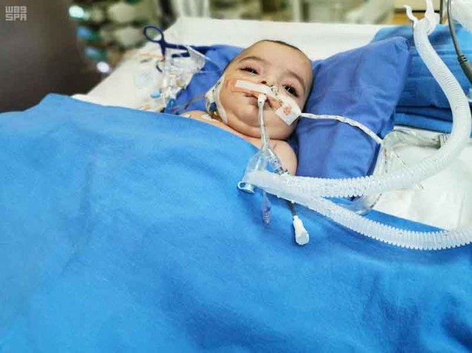 Libyan twins in stable condition 5 days after Riyadh surgery
