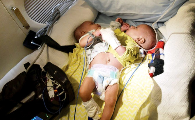 Conjoined Mauritanian twins arrive in Saudi Arabia for separation