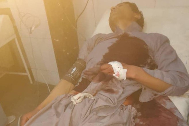 Afghan journalist Jawed Yusufi was recently stabbed and beaten in Kabul. (CPJ via Jawed Yusufi)