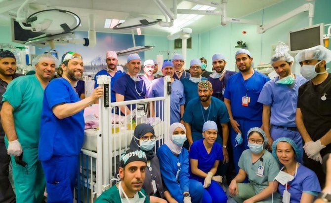 Saudi surgeons separate Yemeni twins after complicated 15-hour operation