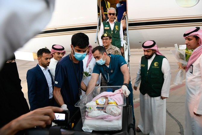 Saudi Arabia’s KSrelief to separate Yemeni conjoined twins on Thursday
