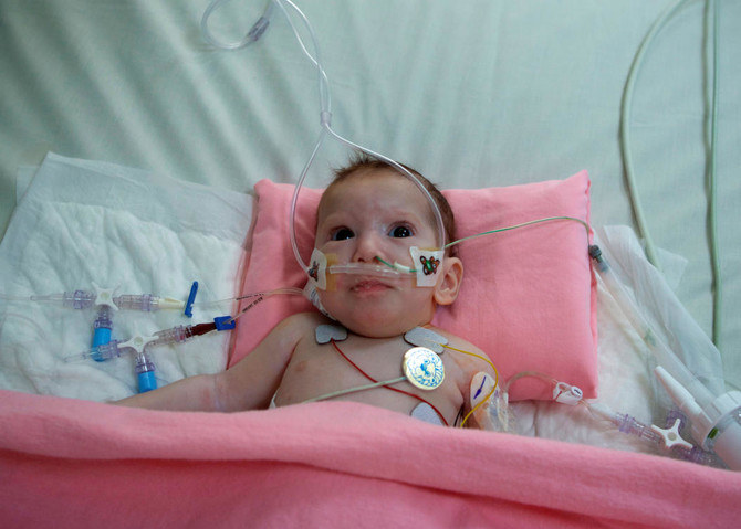 Saudi surgeon who gave Gaza’s conjoined twin new lease of life fearful about her fate