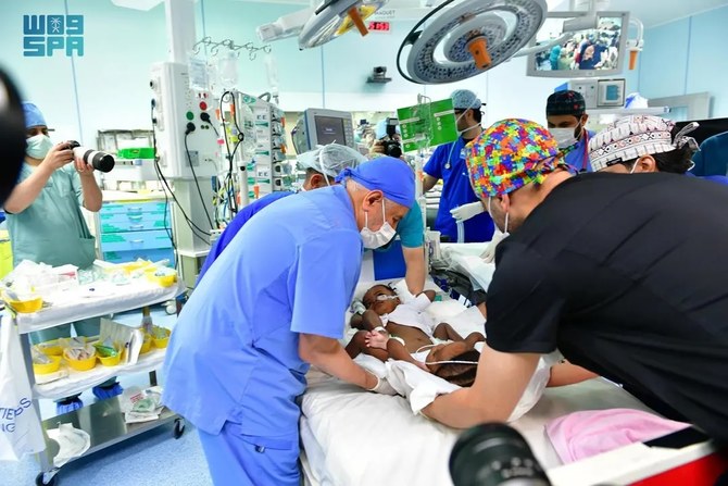 Saudi surgeons successfully complete complex 16-hour operation separating Nigerian conjoined twins