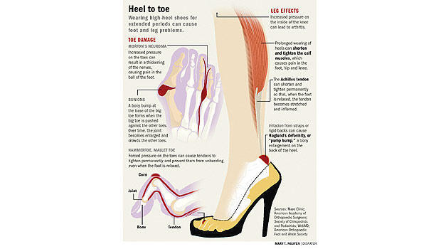 Painfully high holiday heels? Tips to save your soles