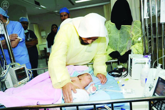 Minister leads surgery to separate Siamese twins